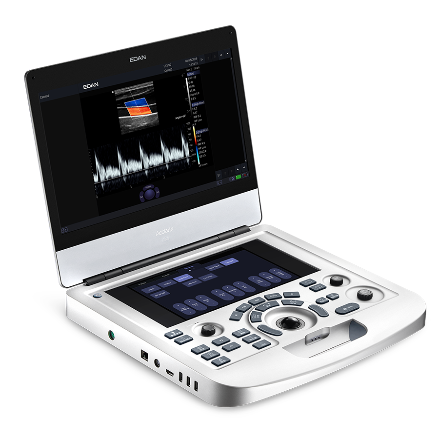 ax3 005