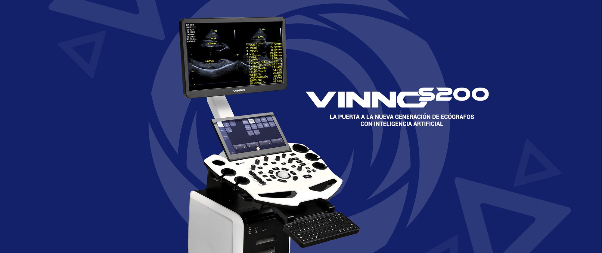 banner-vinnoS200-1 banner-vinnoS200-1