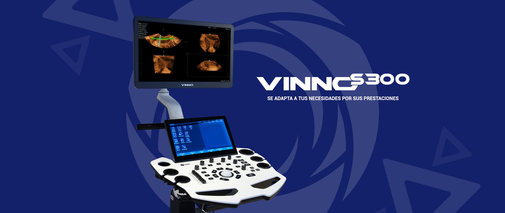 banner-vinnoS300-1 banner-vinnoS300-1