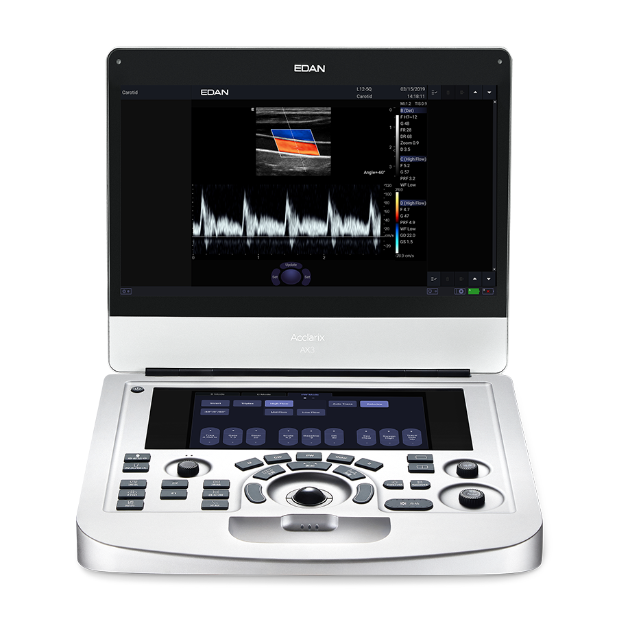 ax3 002 ax3 002