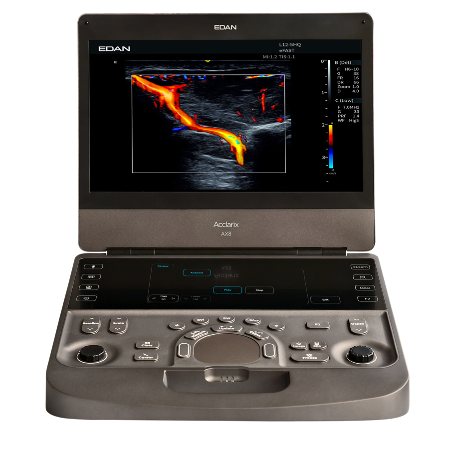 ax8 003 ax8 003